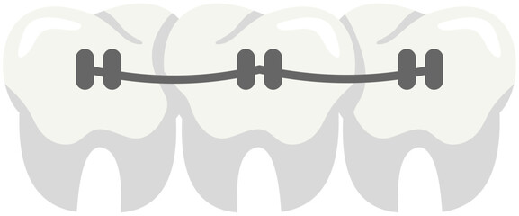 Dental Braces Illustration. Editable Color Vector