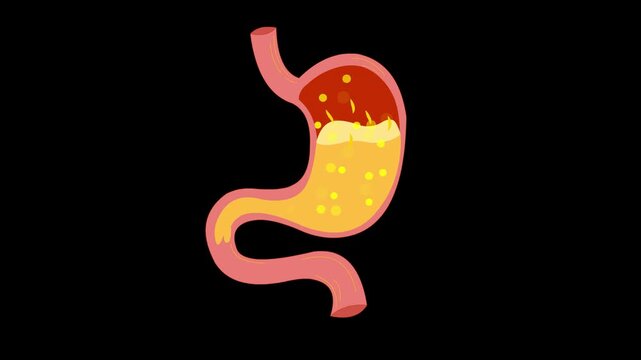 Stomach acidity concept animation with alpha matte