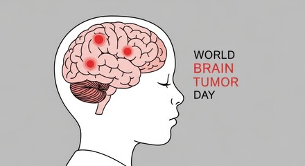 World Brain Tumor Day awareness medical illustration