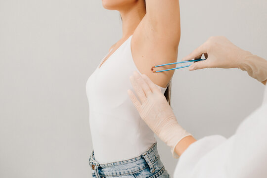 Examination of skin neoplasm and lesions of young woman. Dermatologist examines moles or birthmark of girl patient for revention of melanoma and skin cancer close-up. Checking for benign moles.