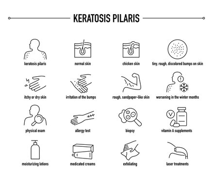 Keratosis Pilaris symptoms, diagnostic and treatment vector icon set. Line editable medical icons.