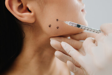 Bruxism injection facial for a treatment with botulinum toxin in an aesthetic medicine clinic. Bruxism injecting for teeth grinding by a cosmetologist.