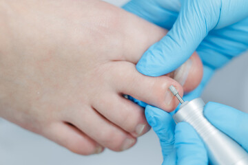 Foot care treatment: close-up of female pedicure procedure with electronic tool