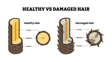 Layer of healthy and damaged hair structure. Labeled cortex, medulla, cuticle cross section view. Hair care beauty concept. Dermatology education. Vector illustration.