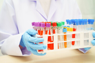 Scientist medical professional use test tube for research in science laboratory.