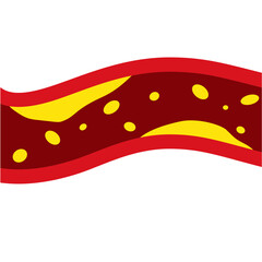 Medical Illustration of Cholesterol Buildup in Artery