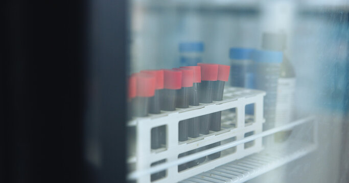 Science, tube and vial with blood in fridge for biotech, dna investigation and medical research. Container, sample and liquid in freezer for genetic testing, stem cell innovation or scientific study.