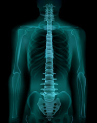 Medical x-ray scan of the human anatomy showing the chest, spine, and full skeleton © itbfydesignlab