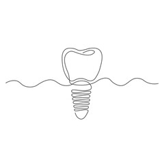 Continuous Line Drawing of a Dental Implant