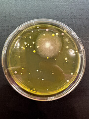 Multicolored colonies of microorganisms on a Petri dish, close-up.
