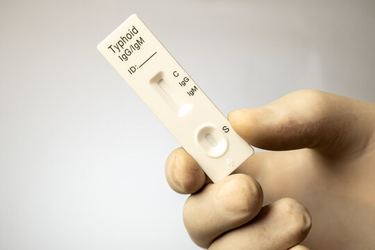 Hand holding a rapid immunochromatographic assay device for diagnosing Typhoid fever.