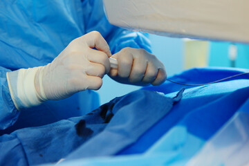 Surgical interventions on blood vessels. Vascular surgery. Modern operating room. Removal of blood clots. Prevention of blood clots. Concept of health care.