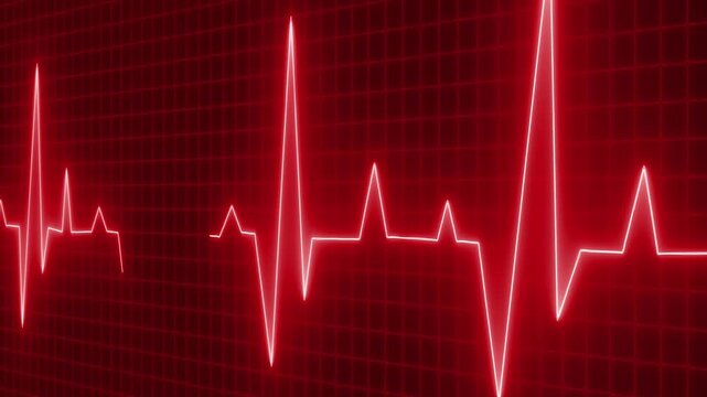 Digital representation of an electrocardiogram ECG showing heartbeats on a grid background