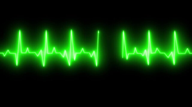 Animated Neon ECG EKG Line Graph Pulse Signal on Black Background