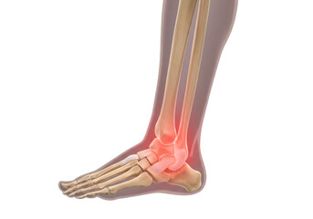 Isolated ankle anatomy of human foot showing bones and related ligaments and highlighting pain