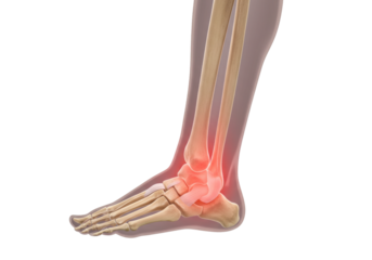 Isolated ankle anatomy of human foot showing bones and related ligaments and highlighting pain