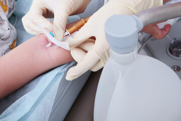 An intravenous cannula is installed on the child's arm. Surgery under anesthesia. The child is undergoing surgery. The concept of healthcare and medicine.