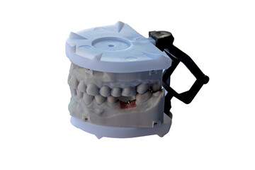 Dental model with upper and lower teeth mounted in plastic articulator for orthodontic and prosthodontic treatment planning