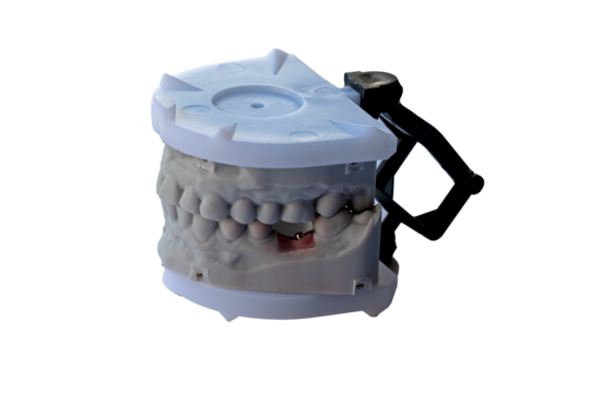 Dental model with upper and lower teeth mounted in plastic articulator for orthodontic and prosthodontic treatment planning