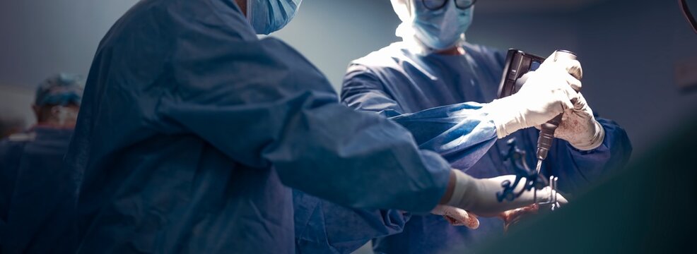 Surgeons in an operating room use robotic assisted technology for precision during knee replacement surgery. They wear surgical gowns, gloves, and masks in a sterile environment - Powered by Adobe