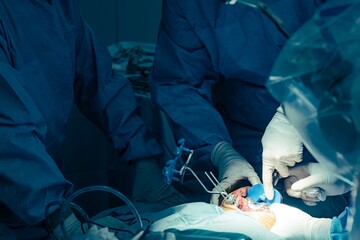 In bright light, surgical team members wearing gloves and gowns use the Rosa robotic system during a knee replacement procedure at a hospital to improve patient outcomes