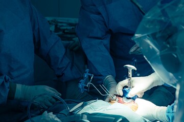 Doctors wearing surgical scrubs and gloves perform a knee replacement with the help of robotic technology in an operating room, showcasing modern medical advancement