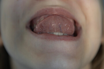 Close view of a person showing their tongue and teeth in a neutral expression captured indoors