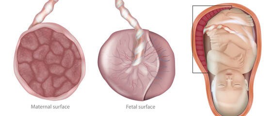 Medical illustration of the human placenta with both maternal and fetal surfaces, connected to the umbilical cord, and a fetus inside the uterus. Human placenta anatomy