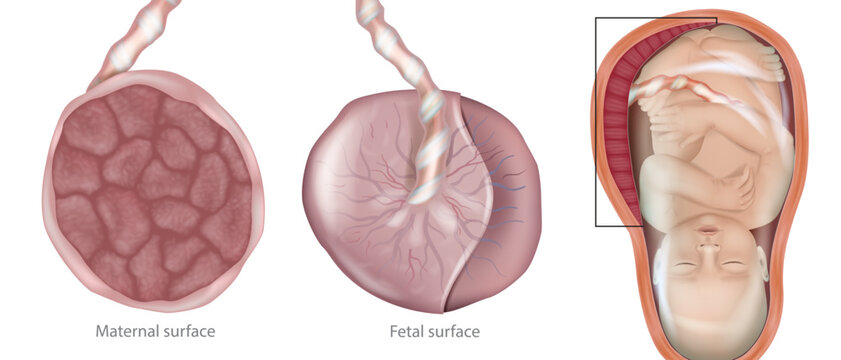 Medical illustration of the human placenta with both maternal and fetal surfaces, connected to the umbilical cord, and a fetus inside the uterus. Human placenta anatomy