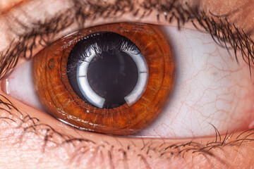 Close-up view of a child's eye showcasing detailed features and colors