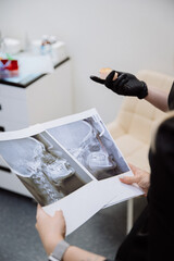 Orthodontic consultation with cephalometric X rays and jaw model, modern dental clinic