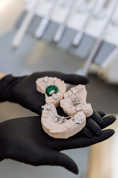 Orthodontic palatal expander models in gloved hands at dental clinic, closeup