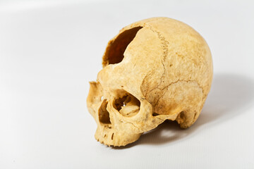 Skull Weathered Human Skull Showcasing Interior Anatomical Structure
