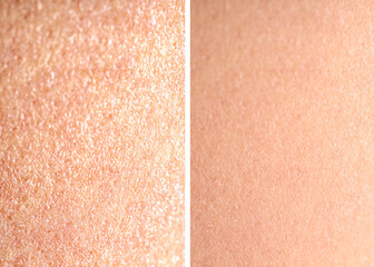 Fototapeta premium Dry skin before and after moisturizing, marco view. Collage for comparison