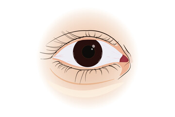 Human eye illustration showing redness or irritation in the inner corner. eps 10