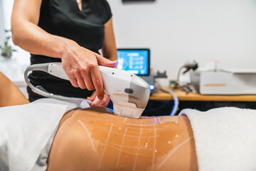 Professional performing a high intensity focused ultrasound (hifu) procedure on a patient's abdomen for skin tightening and rejuvenation