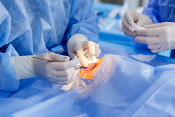 Blepharoplasty eyelid surgery closeup with forceps and swab in a sterile ophthalmic theatre