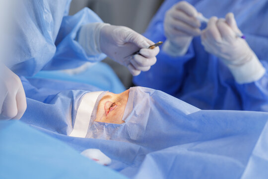 Blepharoplasty closeup with eyelid incision under microscope in sterile operating room