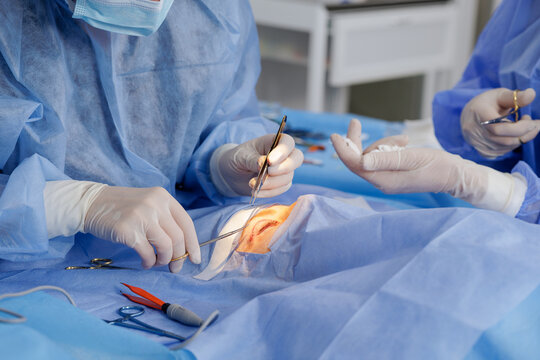 Surgeon suturing upper eyelid during blepharoplasty in a sterile operating room