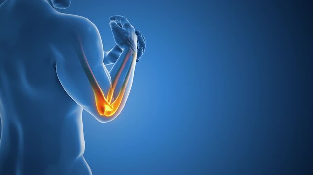 Feeling Joint Discomfort and Stiffness Around the Elbow