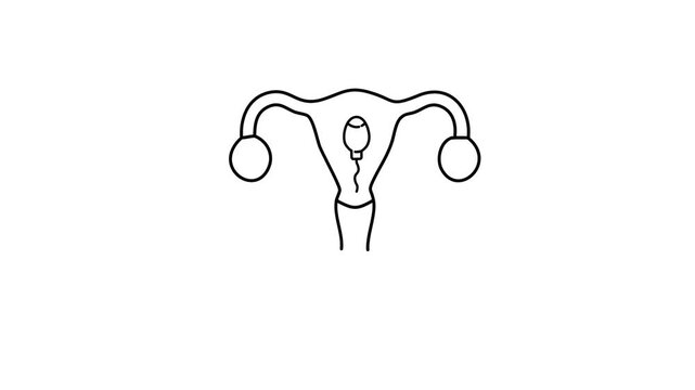 Line art illustration of female reproductive system with a sperm cell approaching the uterus on a white background Keywords: female reproductive system, uterus, ovaries, fallopian tubes, cervix