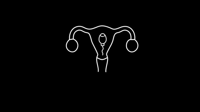 White line art of female reproductive system with sperm cell on black background Keywords: female reproductive system, uterus, ovaries, fallopian tubes, cervix, vagina, ovulation, egg, sperm
