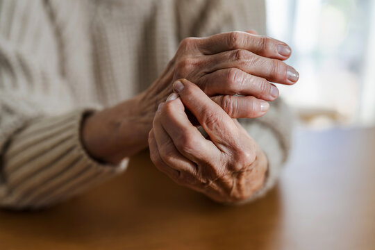 Senior woman with arthritis rubbing hands
