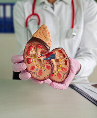 Healthcare professional holds kidney model to explain organ functions during a medical consultation in a clinic