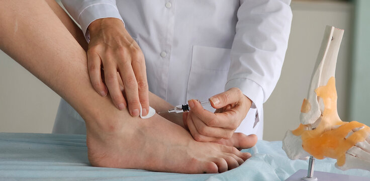 An orthopedic surgeon injects medicine into the Achilles tendon to relieve pain.