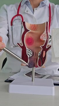 Proctologist  rectum, and bloody swab. Rectal bleeding causes, symptoms, diagnosis, and oncology and cancer