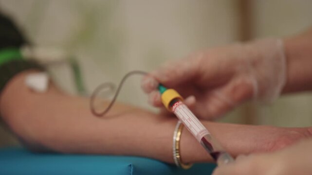 Healthcare professional performing venipuncture on patient arm using vacuum tube system for blood collection, diagnostic testing and routine clinical care in medical clinic setting, slow motion.