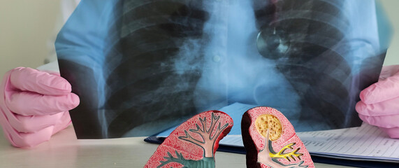 Pneumonia pulmonary diseases anatomy of the lungs. Pneumonia asthma bronchitis symptoms and first signs