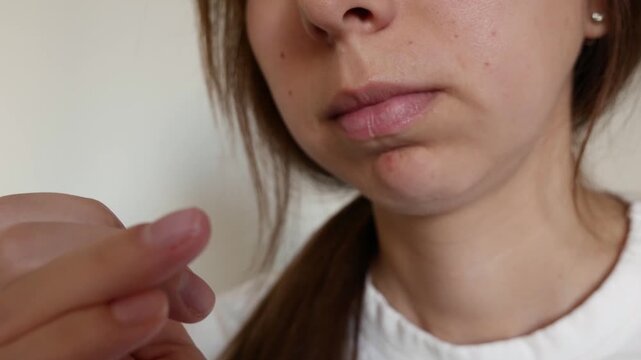Woman with nervous habit biting nails in anxiety