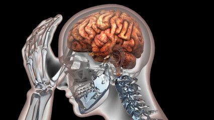 Human Suffering with Severe Headache Anatomy